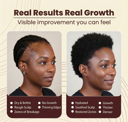 Pure Batana Oil – The Excellence of Hair Growth