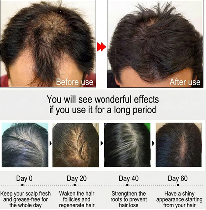 Hair Growth Serum with Batana Oil